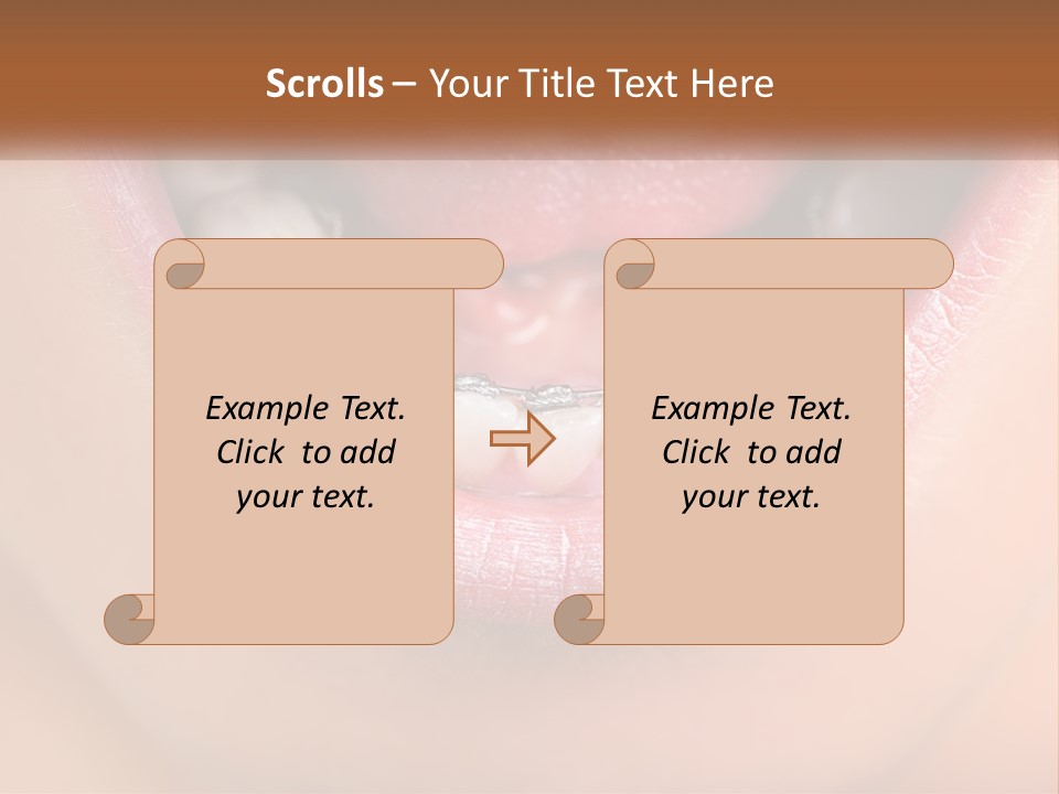 A Close Up Of A Person's Teeth With Braces PowerPoint Template