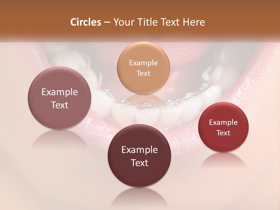 A Close Up Of A Person's Teeth With Braces PowerPoint Template