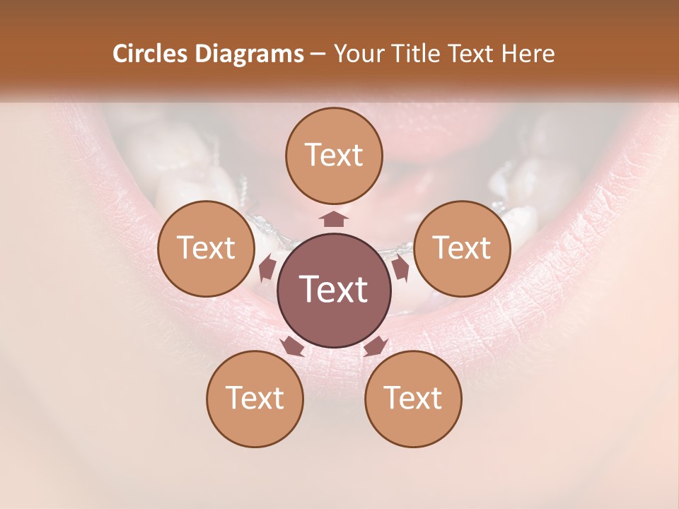 A Close Up Of A Person's Teeth With Braces PowerPoint Template