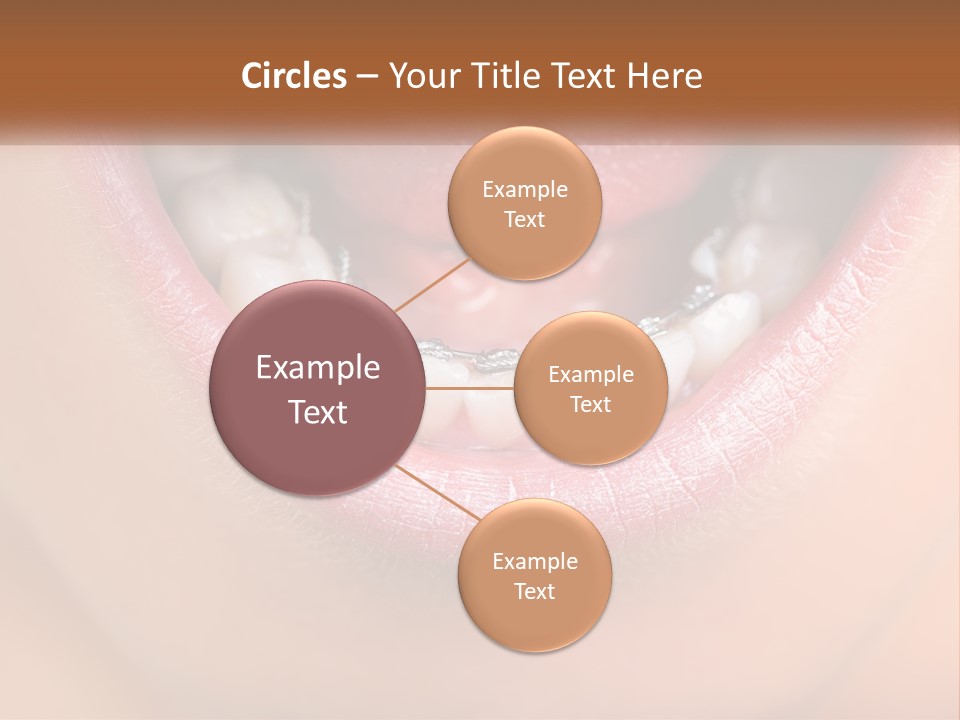 A Close Up Of A Person's Teeth With Braces PowerPoint Template