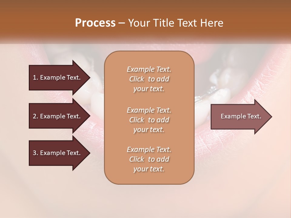 A Close Up Of A Person's Teeth With Braces PowerPoint Template
