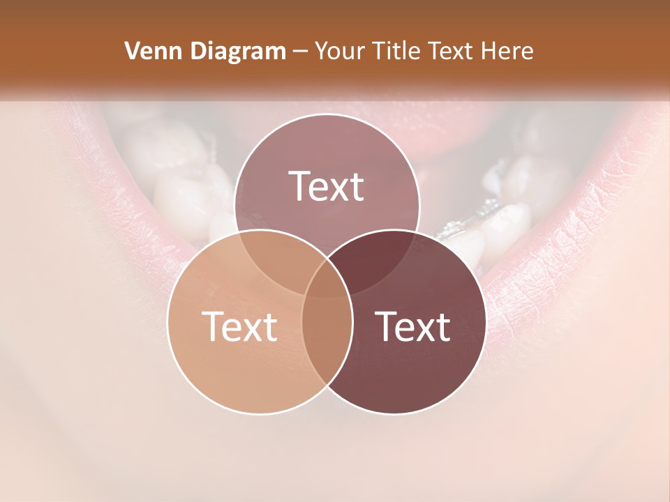 A Close Up Of A Person's Teeth With Braces PowerPoint Template
