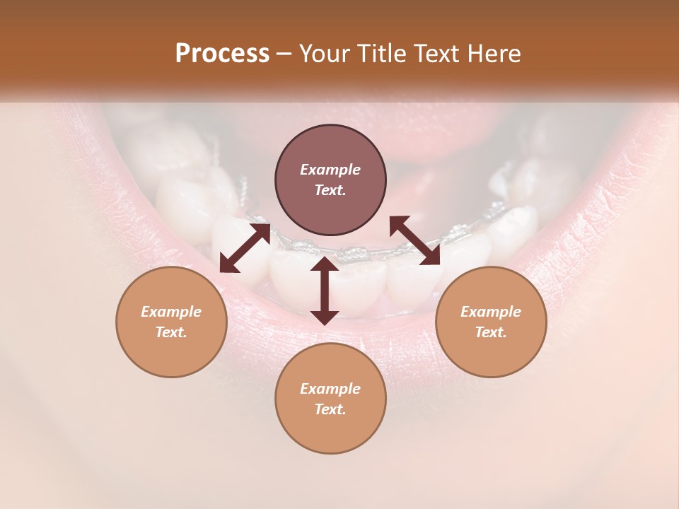 A Close Up Of A Person's Teeth With Braces PowerPoint Template