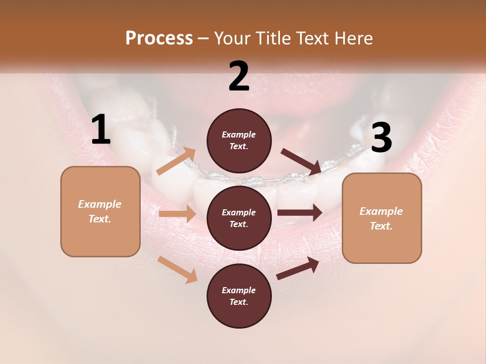 A Close Up Of A Person's Teeth With Braces PowerPoint Template