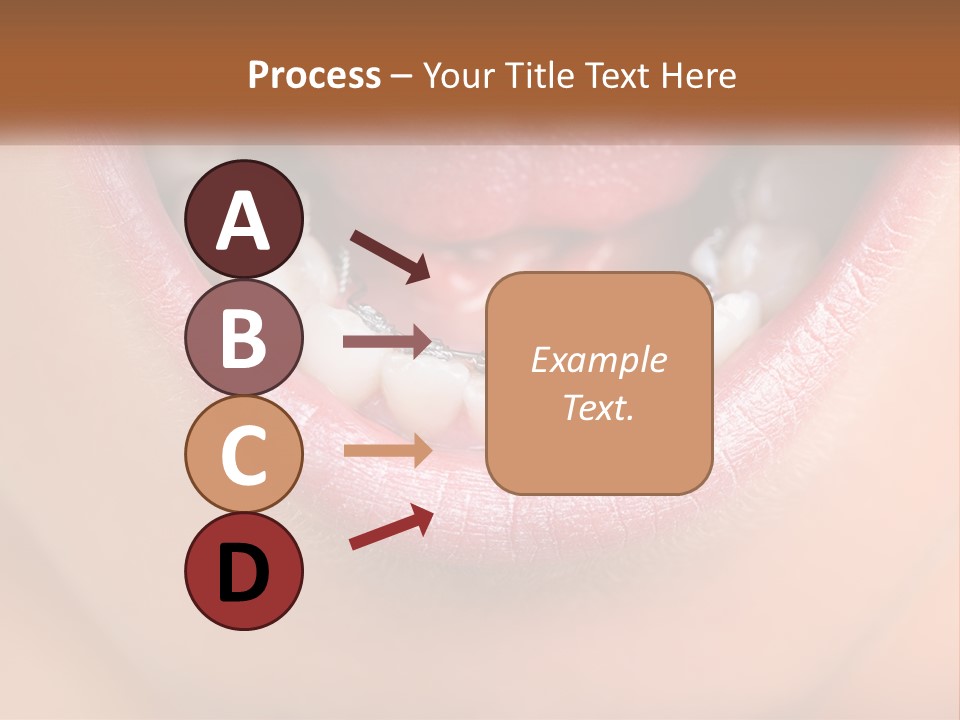 A Close Up Of A Person's Teeth With Braces PowerPoint Template
