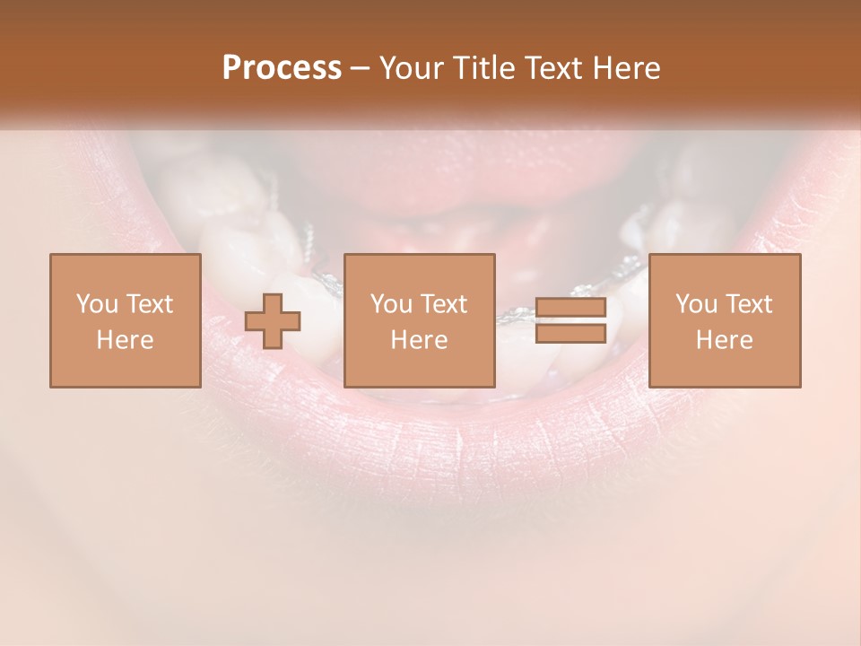 A Close Up Of A Person's Teeth With Braces PowerPoint Template