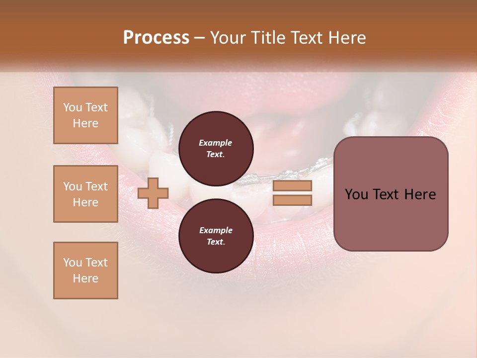 A Close Up Of A Person's Teeth With Braces PowerPoint Template
