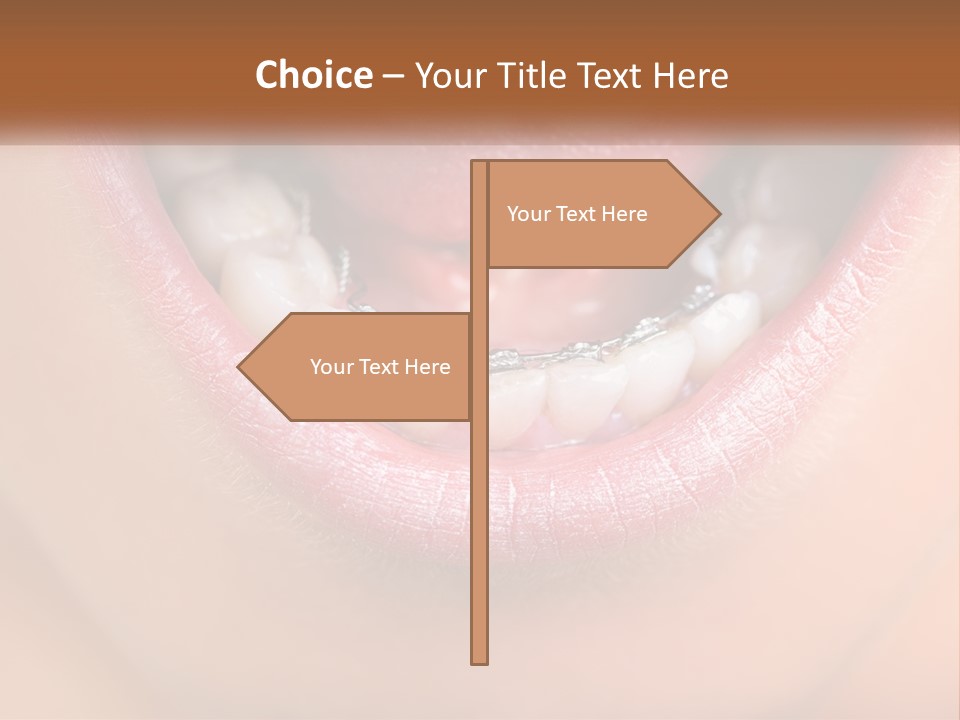 A Close Up Of A Person's Teeth With Braces PowerPoint Template