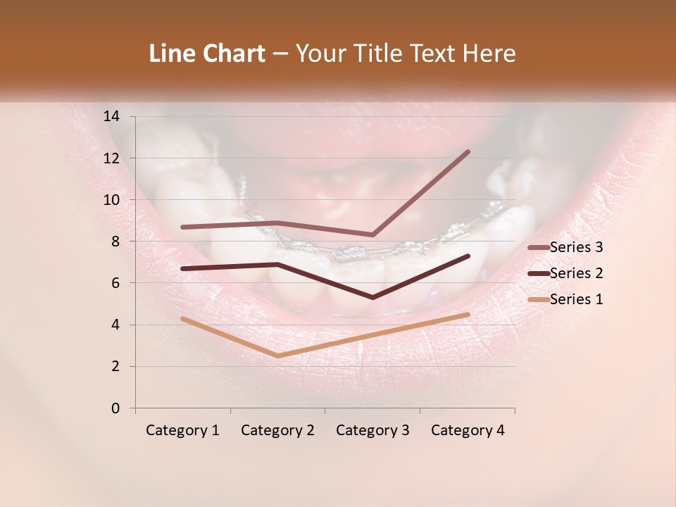 A Close Up Of A Person's Teeth With Braces PowerPoint Template