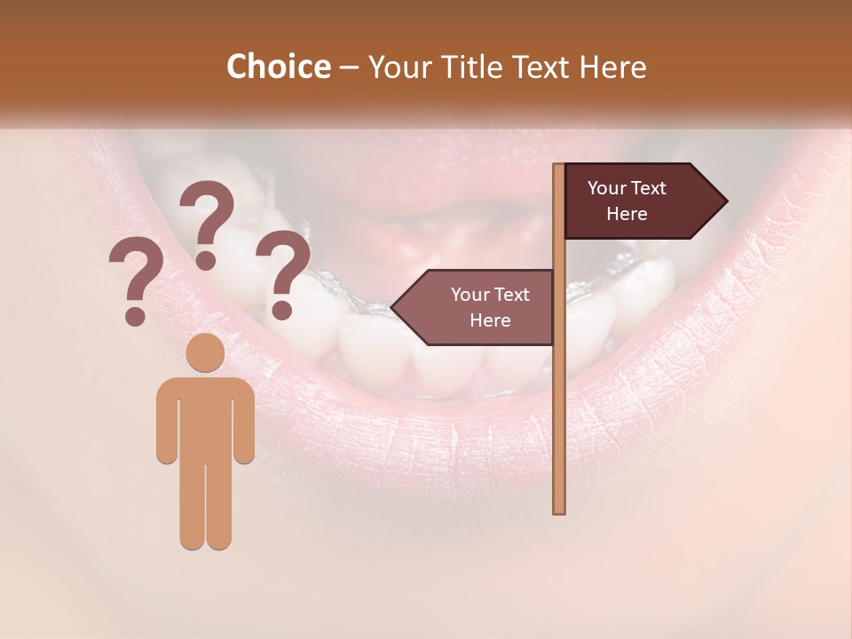 A Close Up Of A Person's Teeth With Braces PowerPoint Template