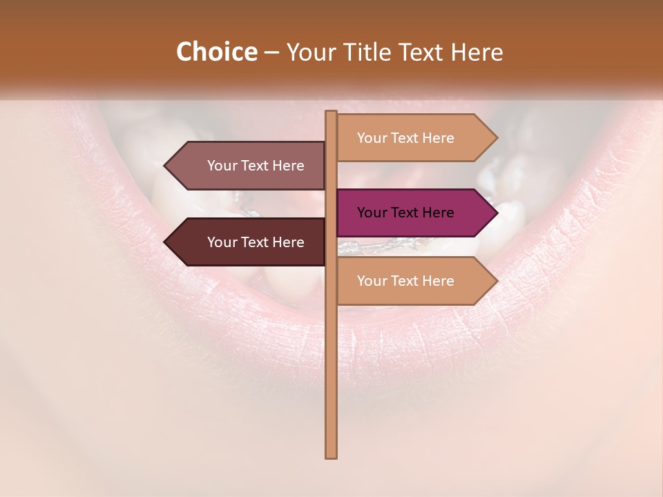 A Close Up Of A Person's Teeth With Braces PowerPoint Template