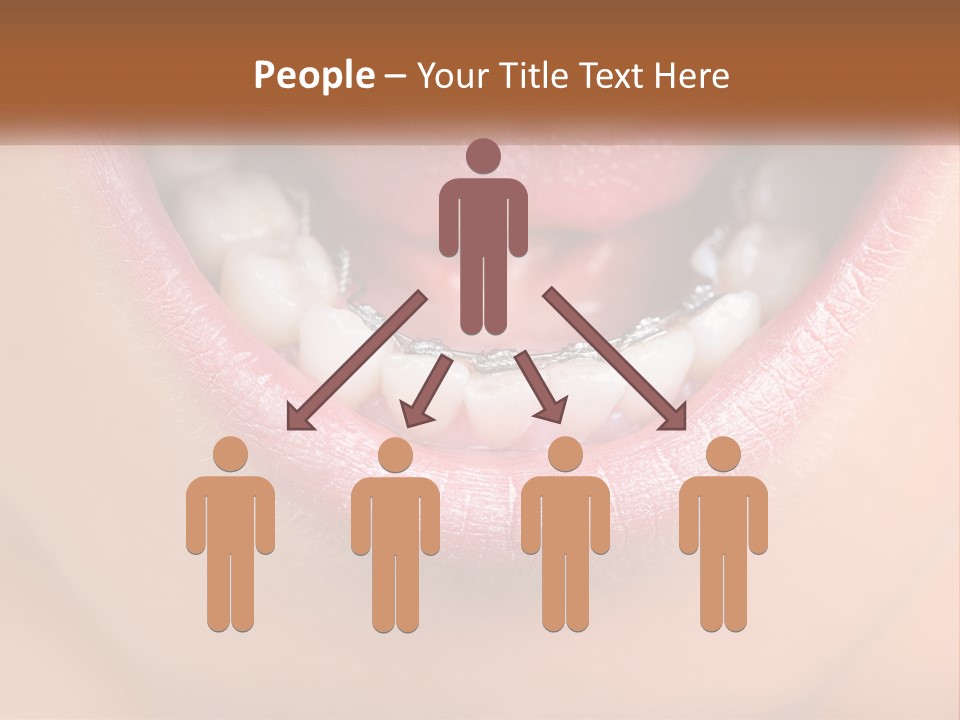 A Close Up Of A Person's Teeth With Braces PowerPoint Template