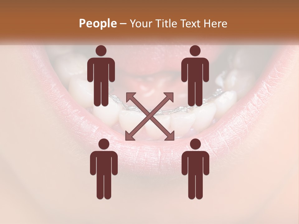 A Close Up Of A Person's Teeth With Braces PowerPoint Template