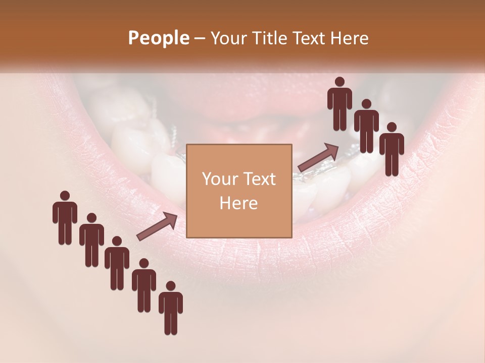 A Close Up Of A Person's Teeth With Braces PowerPoint Template