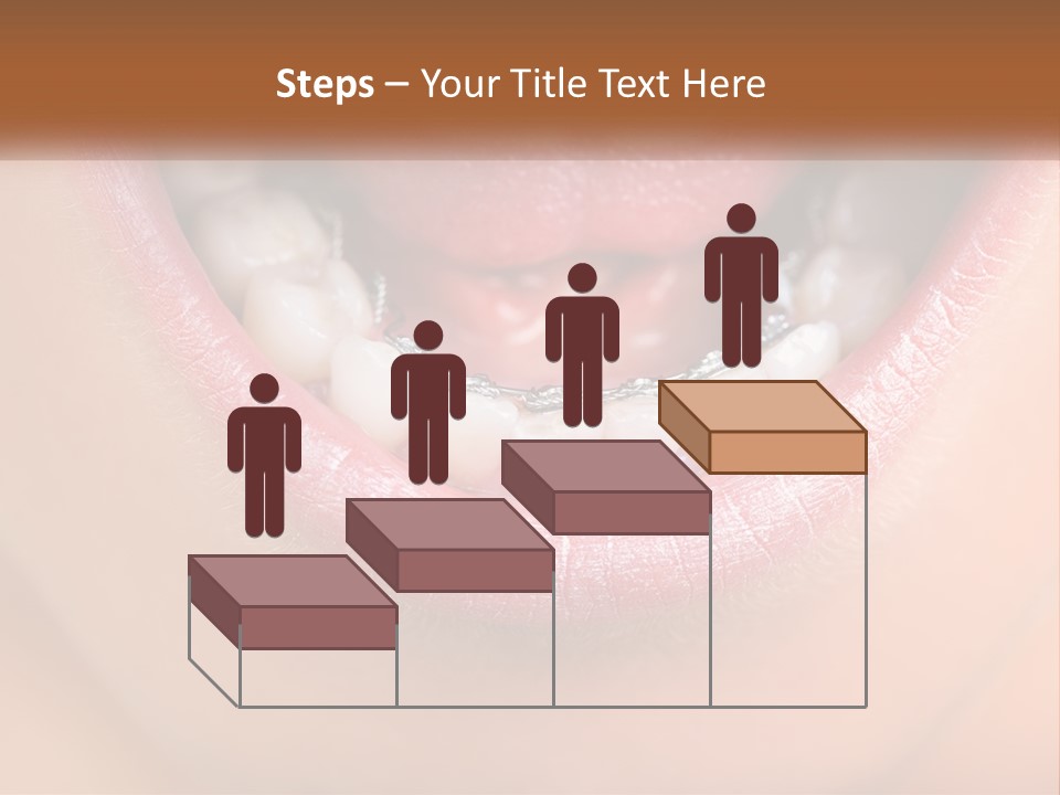 A Close Up Of A Person's Teeth With Braces PowerPoint Template
