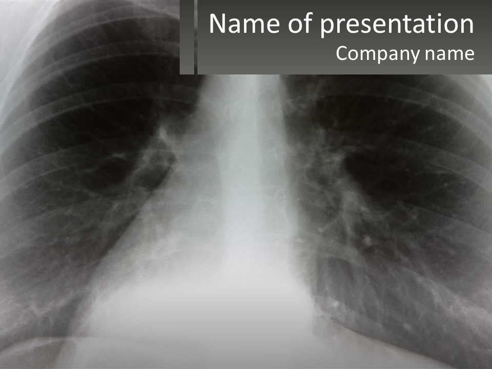 A Picture Of A Lung With The Words Name Of Presentation On It PowerPoint Template