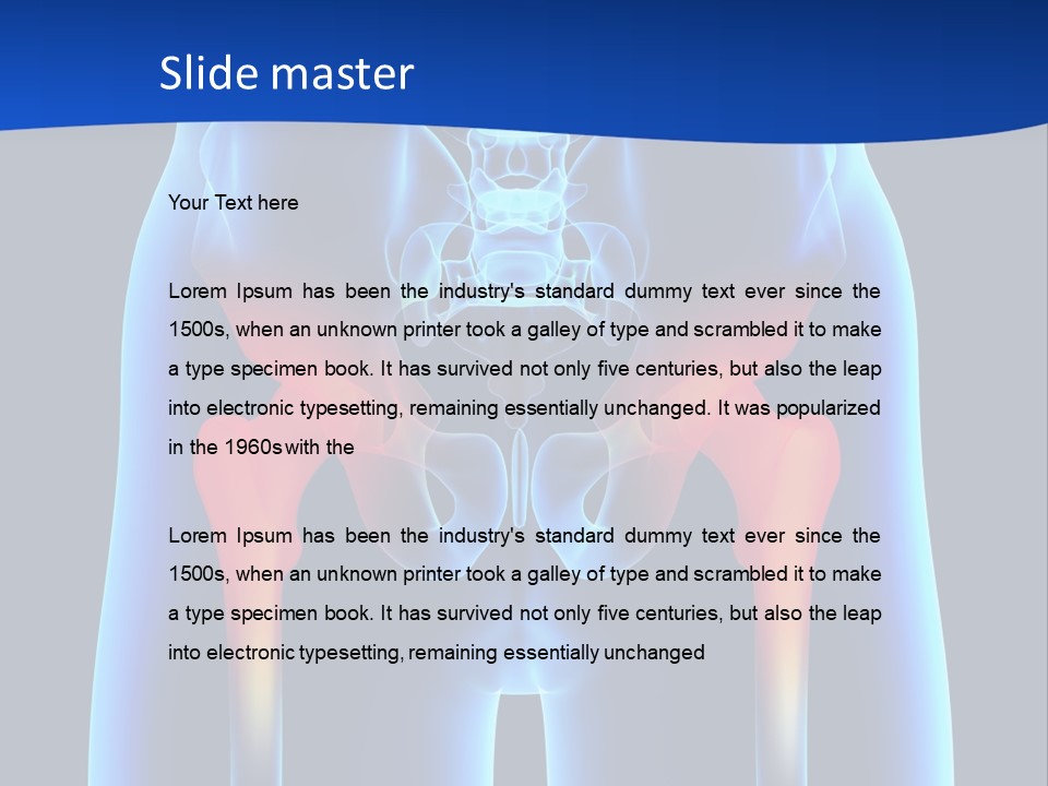 A Medical Powerpoint Presentation With A Highlighted Image Of A Man's Hip PowerPoint Template