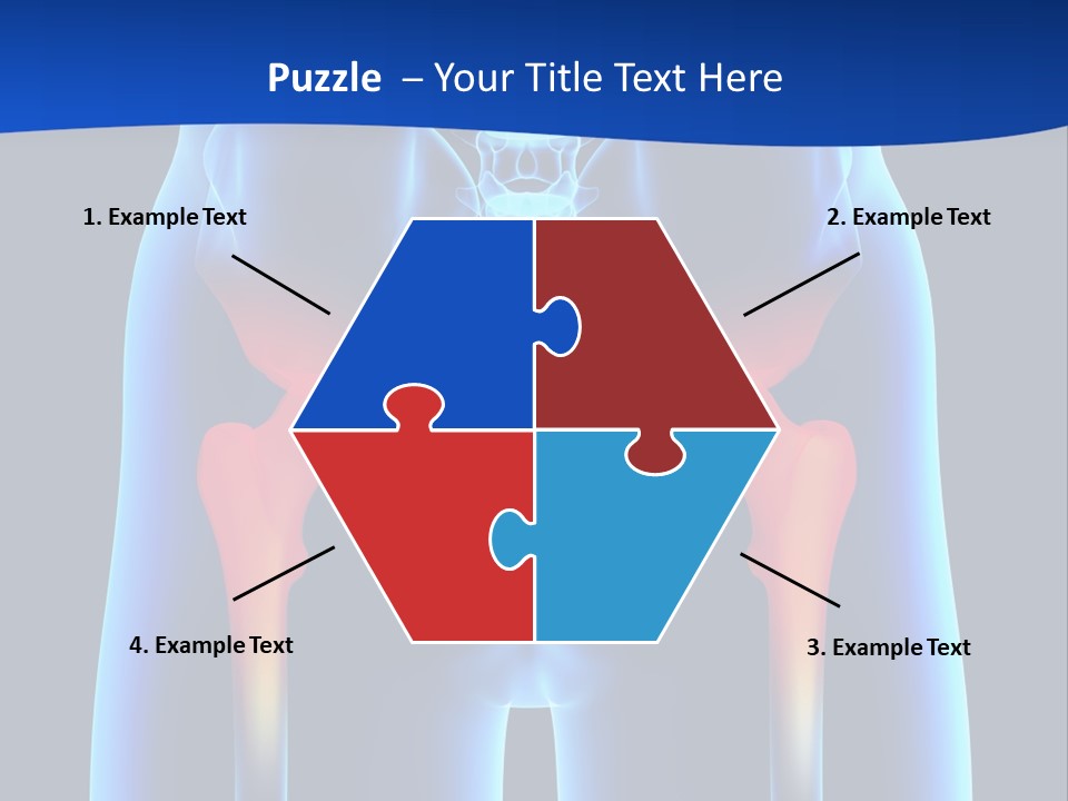 A Medical Powerpoint Presentation With A Highlighted Image Of A Man's Hip PowerPoint Template