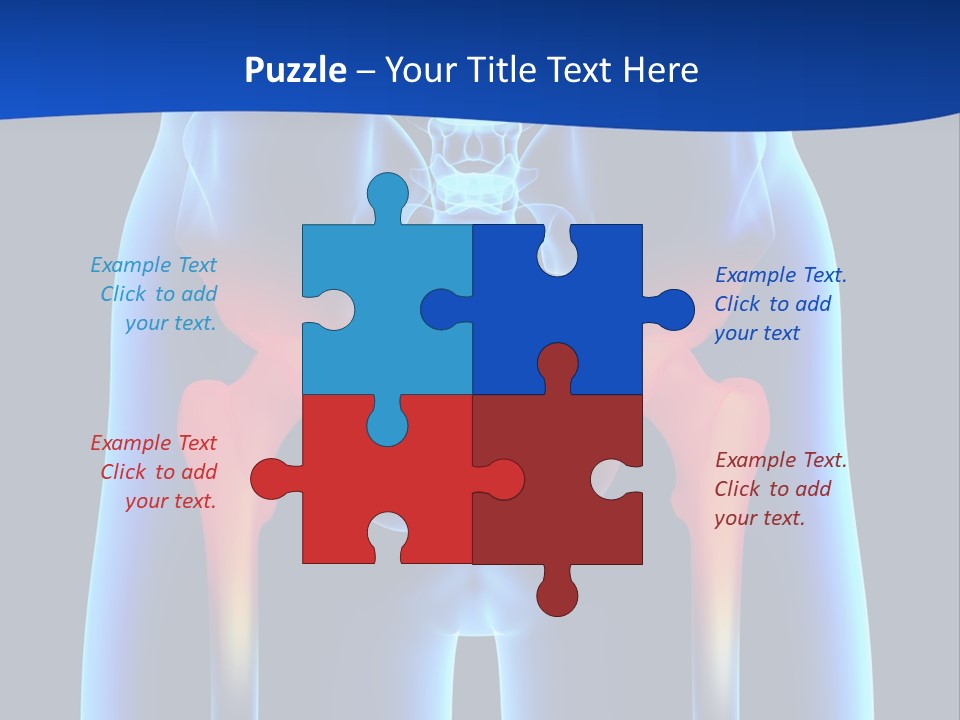A Medical Powerpoint Presentation With A Highlighted Image Of A Man's Hip PowerPoint Template