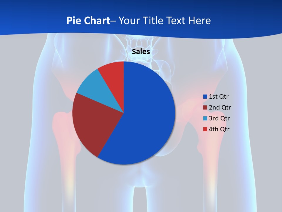 A Medical Powerpoint Presentation With A Highlighted Image Of A Man's Hip PowerPoint Template