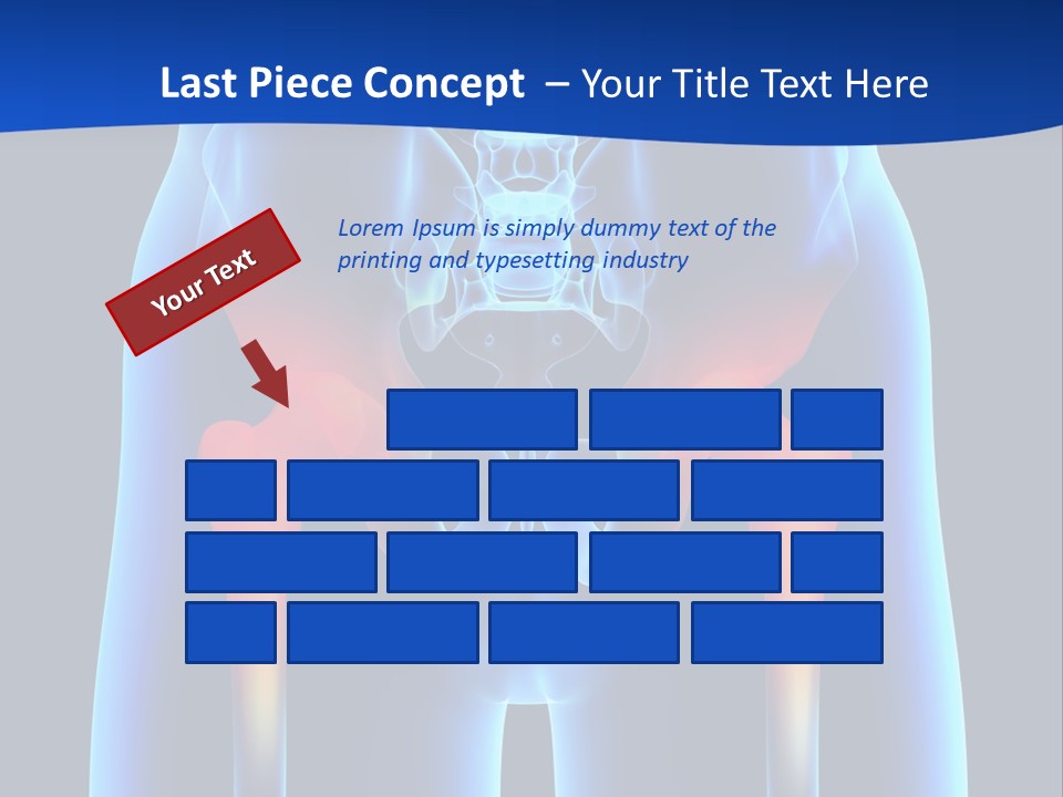 A Medical Powerpoint Presentation With A Highlighted Image Of A Man's Hip PowerPoint Template