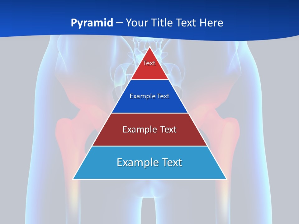 A Medical Powerpoint Presentation With A Highlighted Image Of A Man's Hip PowerPoint Template