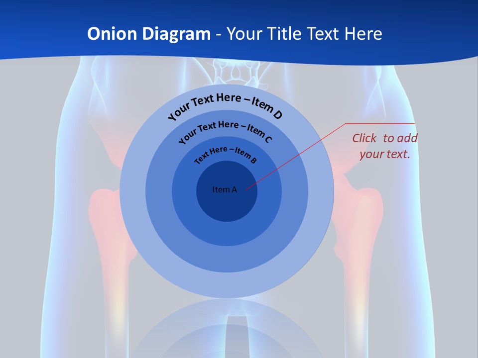 A Medical Powerpoint Presentation With A Highlighted Image Of A Man's Hip PowerPoint Template