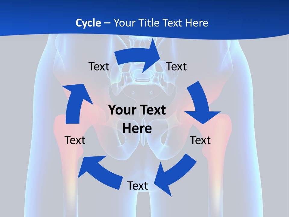 A Medical Powerpoint Presentation With A Highlighted Image Of A Man's Hip PowerPoint Template