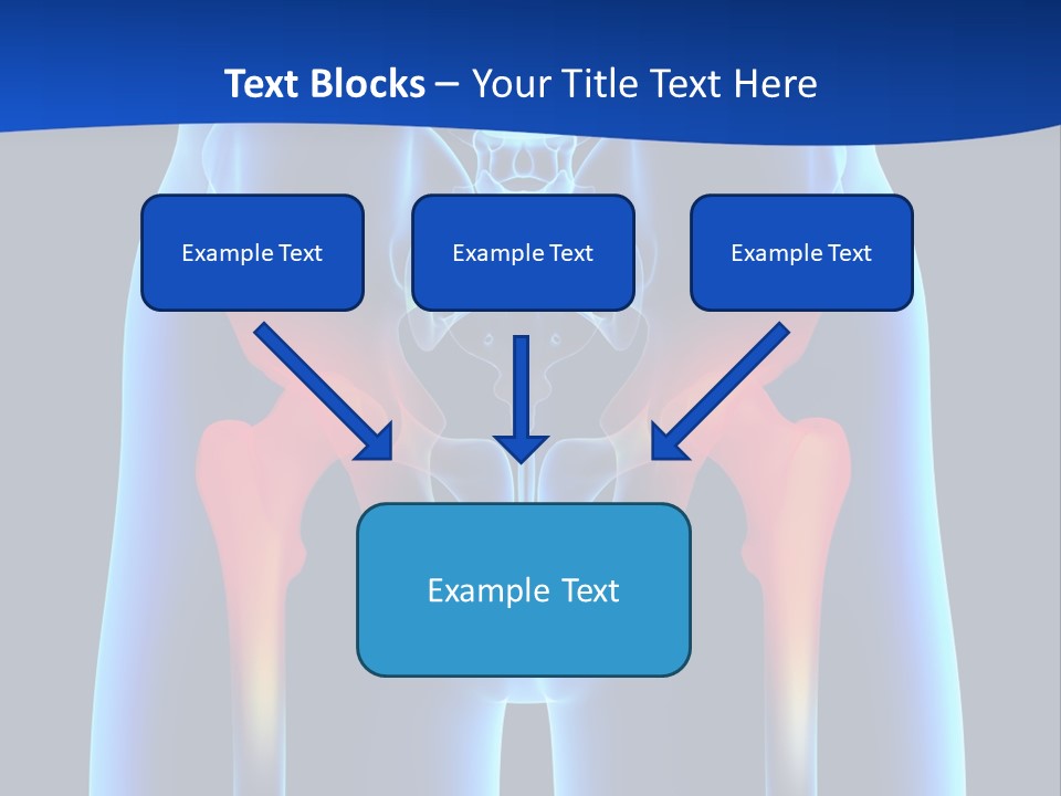 A Medical Powerpoint Presentation With A Highlighted Image Of A Man's Hip PowerPoint Template