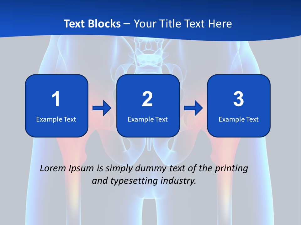 A Medical Powerpoint Presentation With A Highlighted Image Of A Man's Hip PowerPoint Template