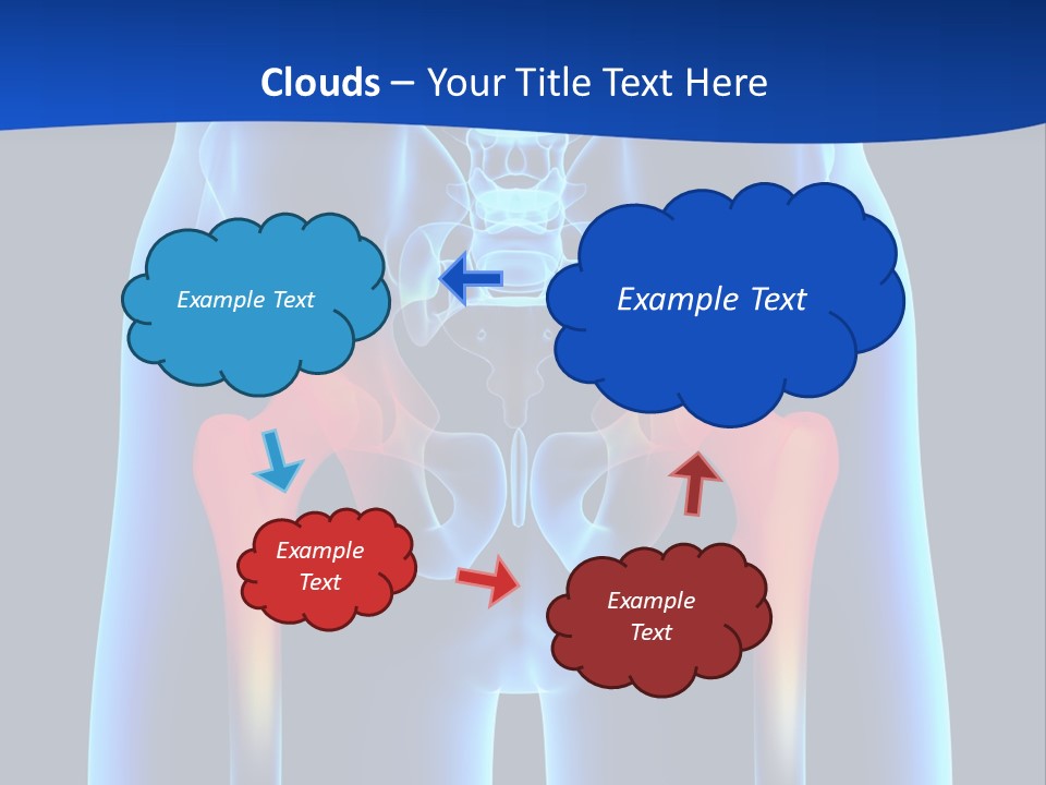 A Medical Powerpoint Presentation With A Highlighted Image Of A Man's Hip PowerPoint Template