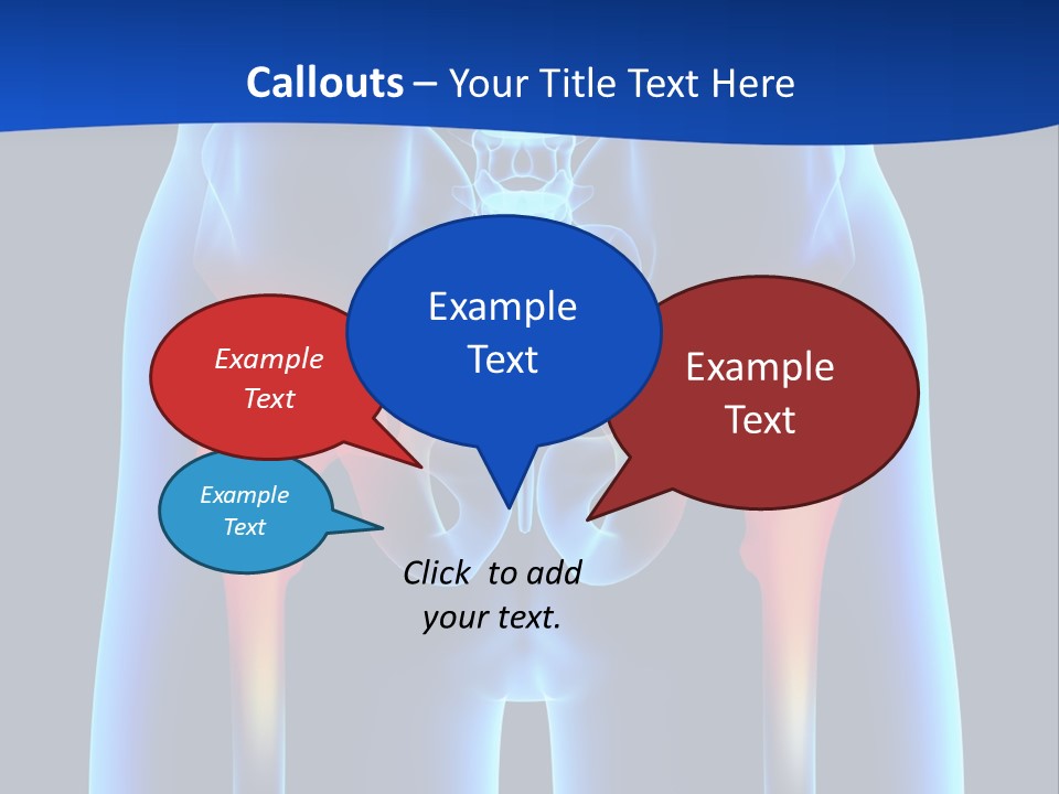 A Medical Powerpoint Presentation With A Highlighted Image Of A Man's Hip PowerPoint Template