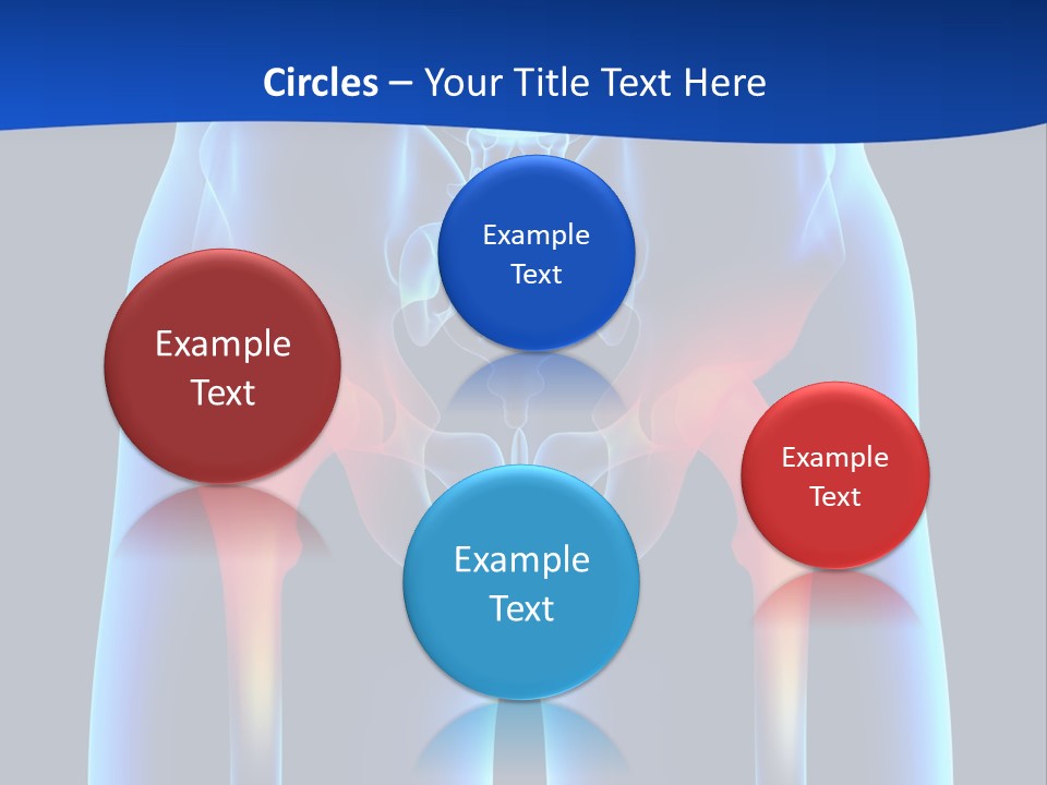 A Medical Powerpoint Presentation With A Highlighted Image Of A Man's Hip PowerPoint Template