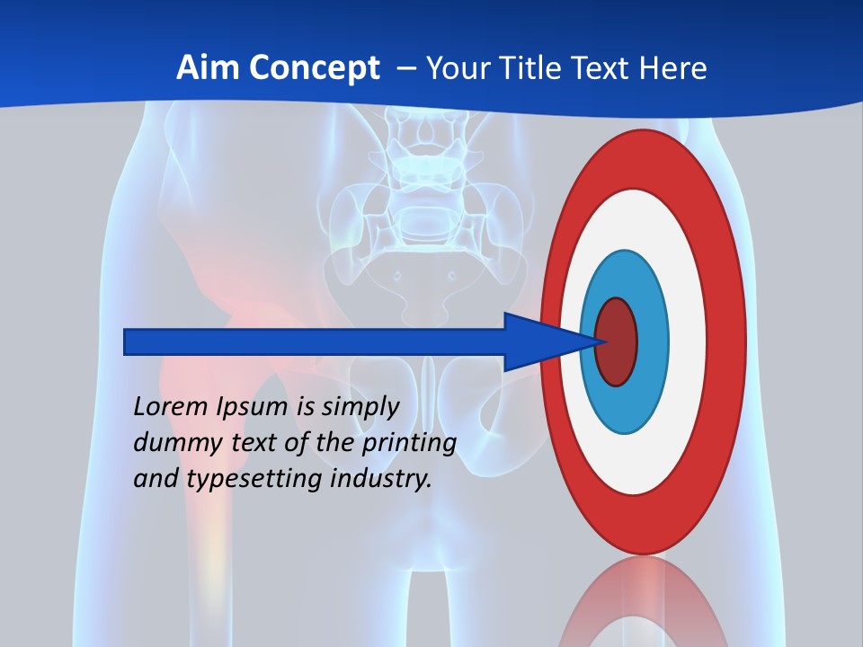 A Medical Powerpoint Presentation With A Highlighted Image Of A Man's Hip PowerPoint Template