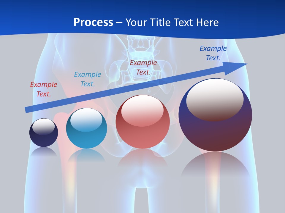 A Medical Powerpoint Presentation With A Highlighted Image Of A Man's Hip PowerPoint Template