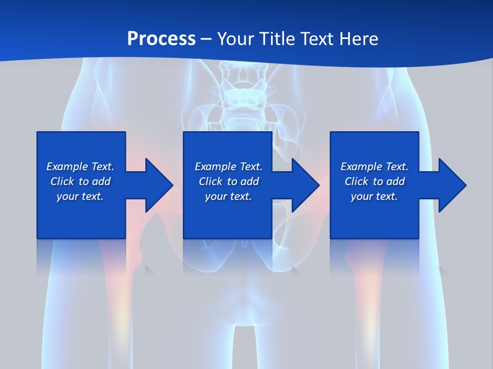 A Medical Powerpoint Presentation With A Highlighted Image Of A Man's Hip PowerPoint Template