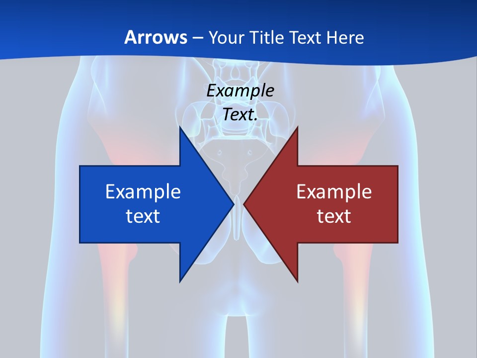 A Medical Powerpoint Presentation With A Highlighted Image Of A Man's Hip PowerPoint Template