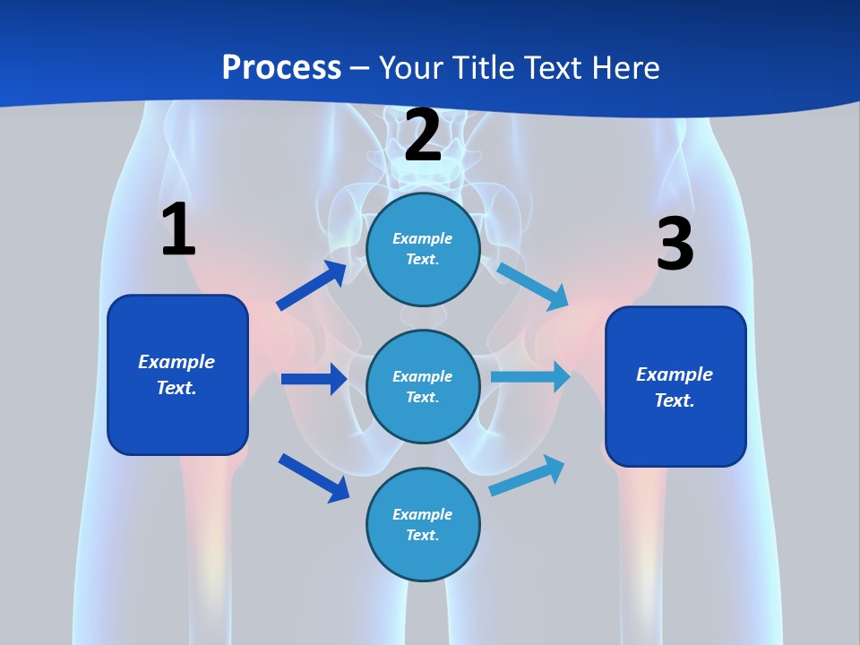 A Medical Powerpoint Presentation With A Highlighted Image Of A Man's Hip PowerPoint Template