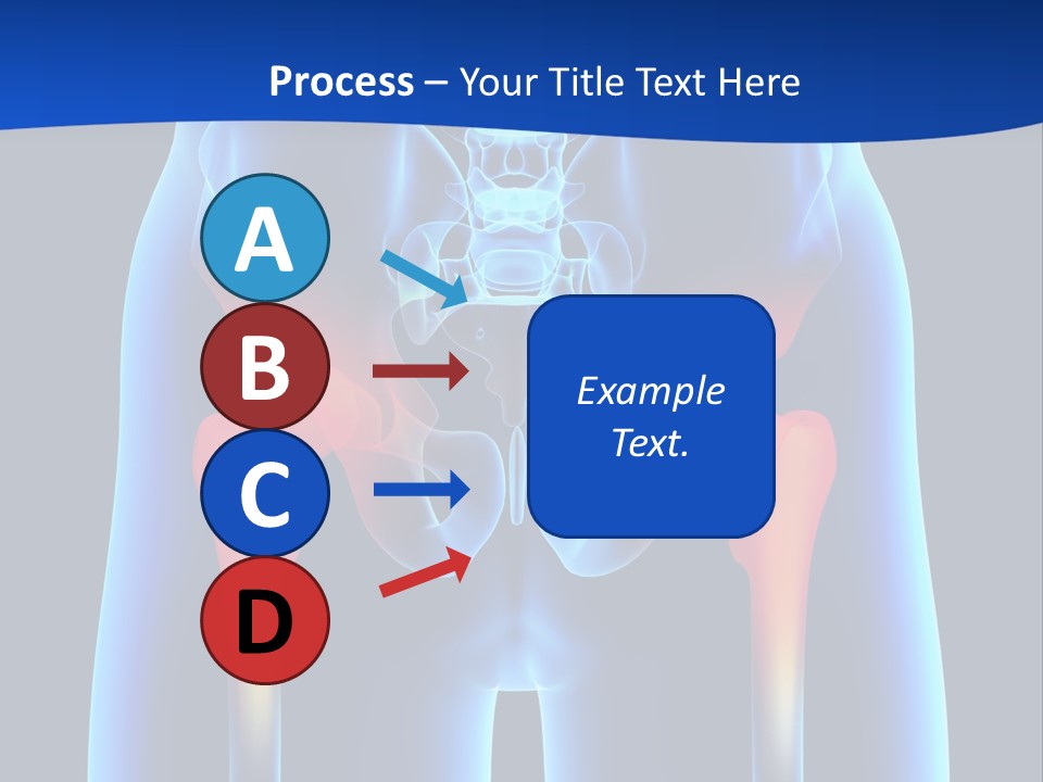 A Medical Powerpoint Presentation With A Highlighted Image Of A Man's Hip PowerPoint Template