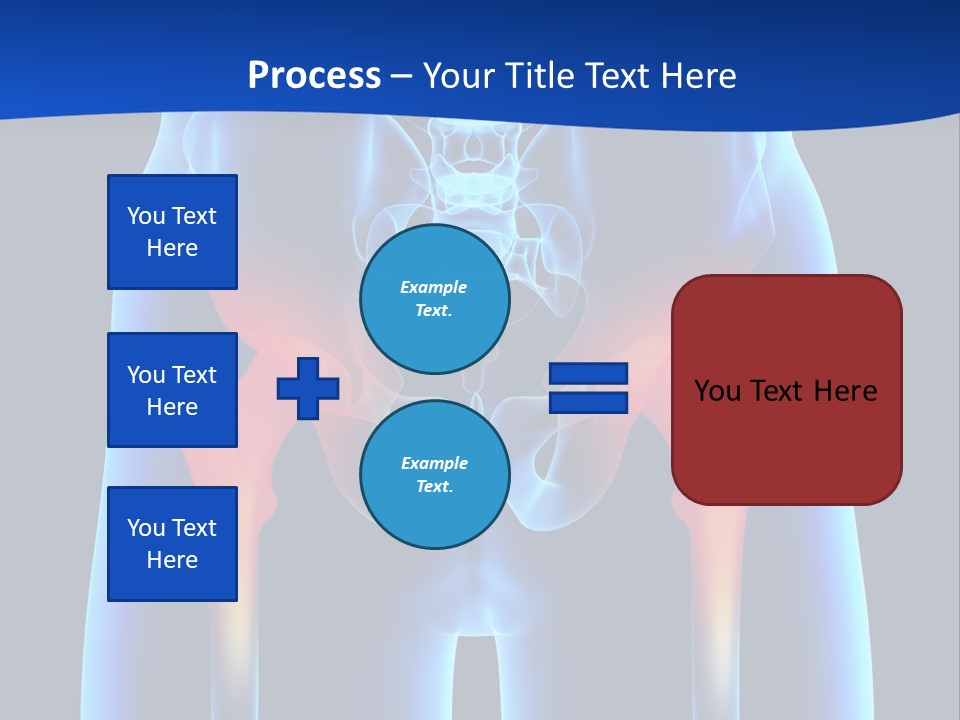 A Medical Powerpoint Presentation With A Highlighted Image Of A Man's Hip PowerPoint Template
