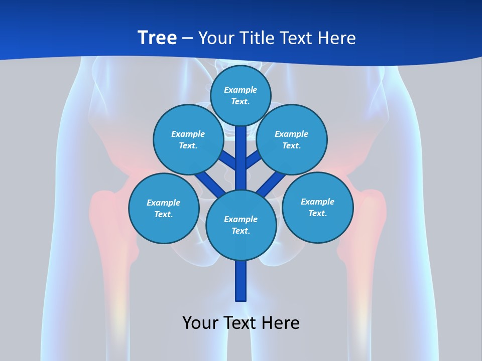 A Medical Powerpoint Presentation With A Highlighted Image Of A Man's Hip PowerPoint Template