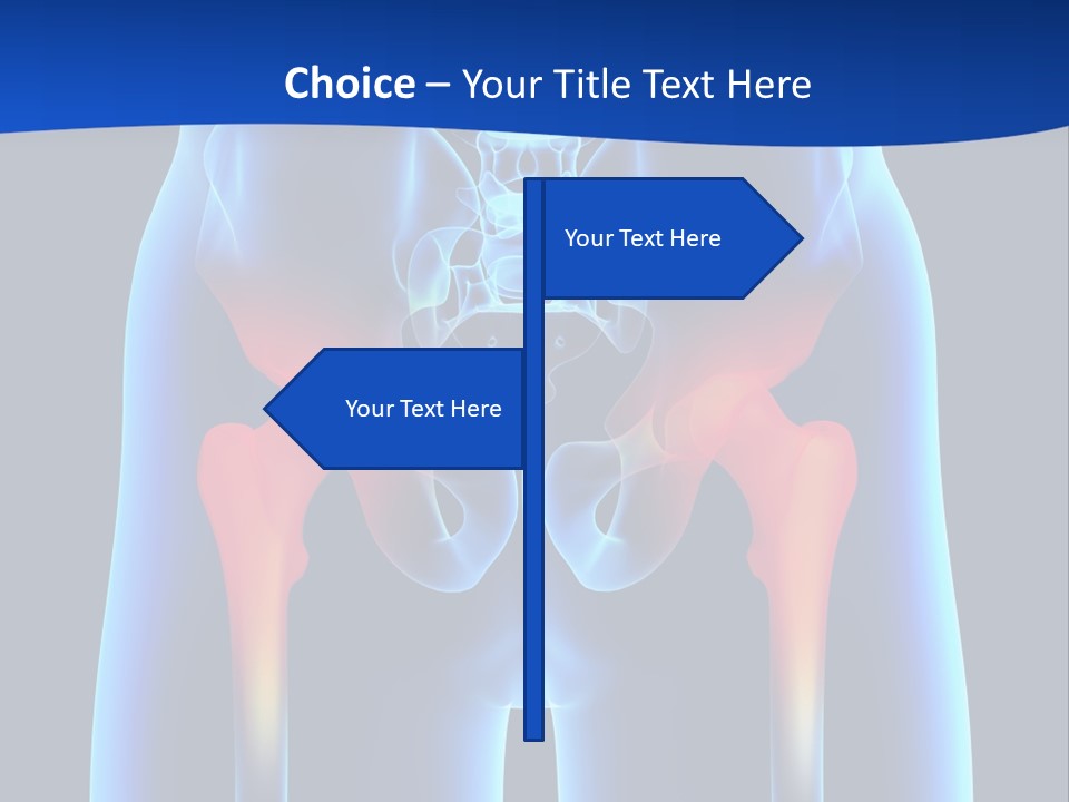 A Medical Powerpoint Presentation With A Highlighted Image Of A Man's Hip PowerPoint Template