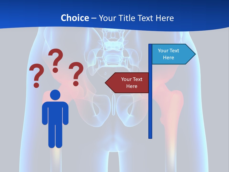 A Medical Powerpoint Presentation With A Highlighted Image Of A Man's Hip PowerPoint Template