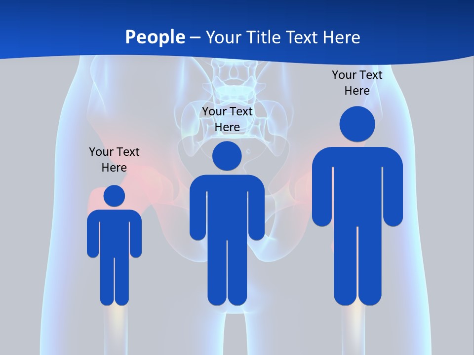 A Medical Powerpoint Presentation With A Highlighted Image Of A Man's Hip PowerPoint Template