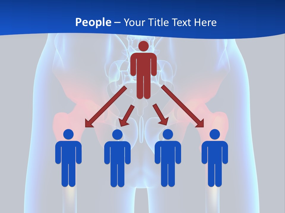 A Medical Powerpoint Presentation With A Highlighted Image Of A Man's Hip PowerPoint Template