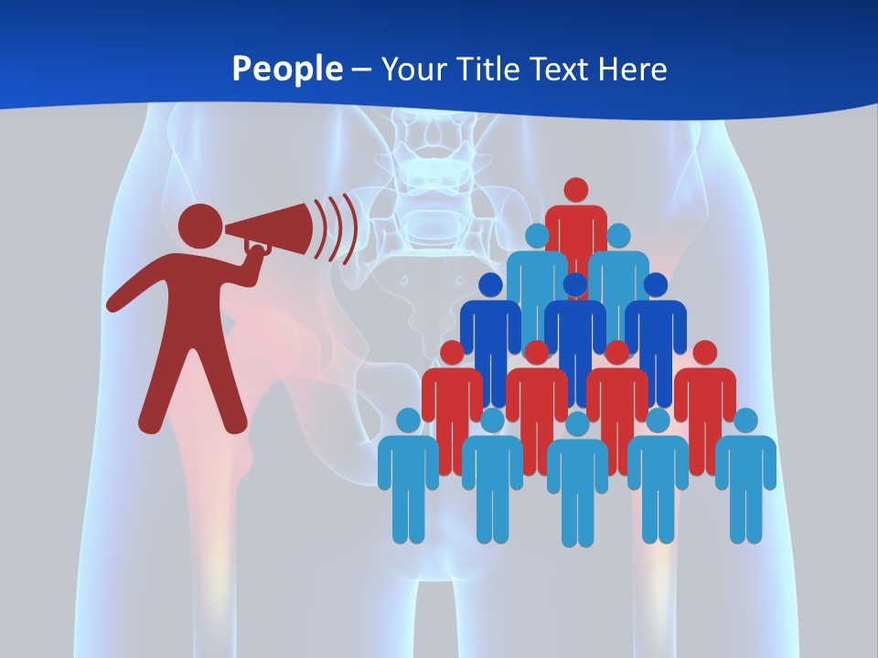 A Medical Powerpoint Presentation With A Highlighted Image Of A Man's Hip PowerPoint Template
