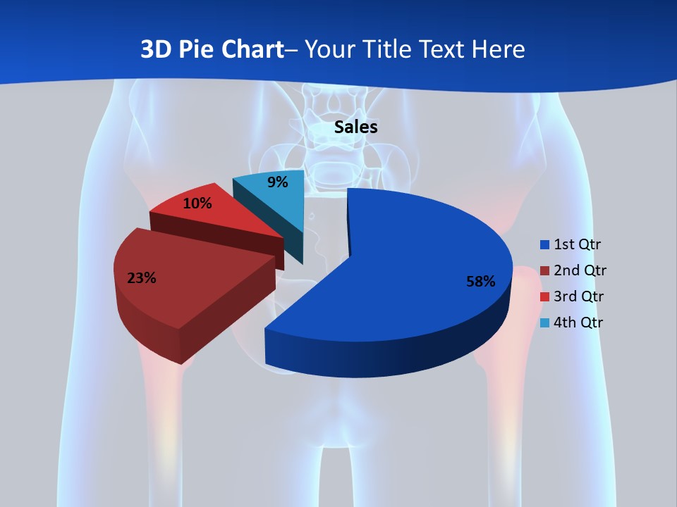 A Medical Powerpoint Presentation With A Highlighted Image Of A Man's Hip PowerPoint Template