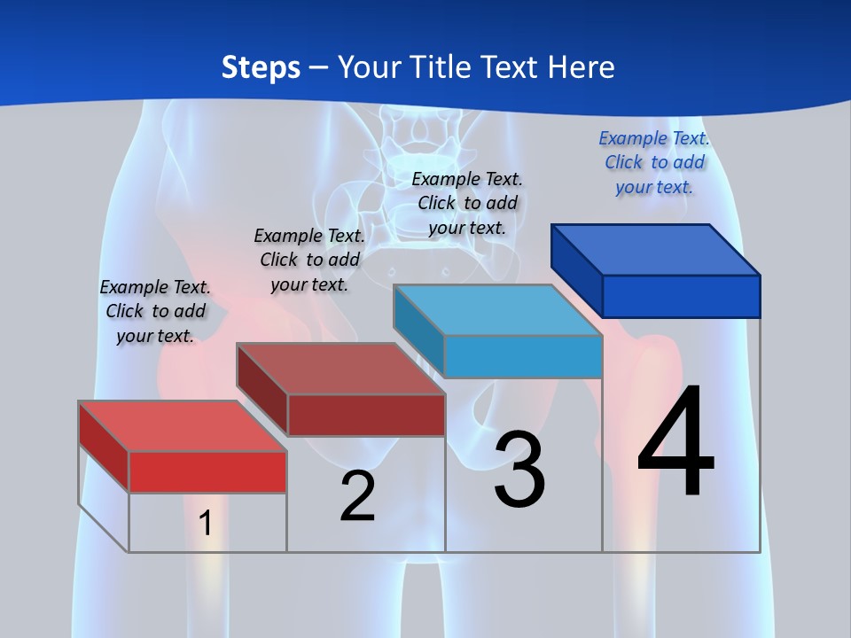 A Medical Powerpoint Presentation With A Highlighted Image Of A Man's Hip PowerPoint Template