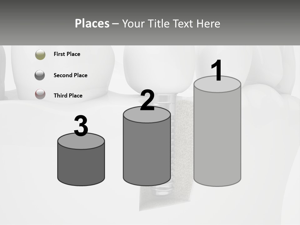 A Tooth With A Dental Implant On Top Of It PowerPoint Template