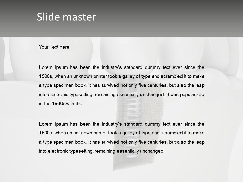 A Tooth With A Dental Implant On Top Of It PowerPoint Template